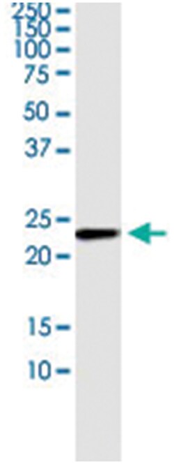 anti-NUDT4, Human, IP-WB Antibody Pair, Abnova™