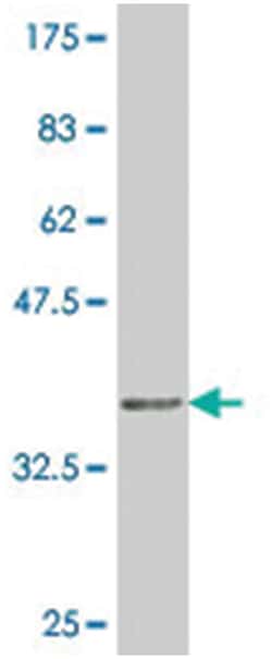 SRY (sex determining region Y)-box 21, Mouse, Clone: 3H4, Abnova 100&mu;g;