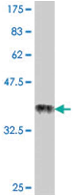 BAZ1A, Mouse, Polyclonal Antibody, Abnova 50&mu;L; Unlabeled:Antibodies,