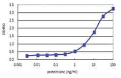 anti-SUPT16H, Human, Matched Antibody Pair, Abnova™