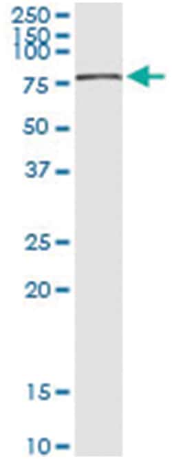 anti-CHEK2, Human, IP-WB Antibody Pair, Abnova™