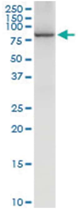 anti-IRAK3, Human, IP-WB Antibody Pair, Abnova™