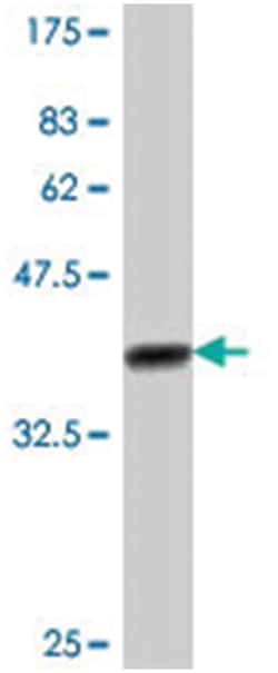 AKAP11, Mouse, Polyclonal Antibody, Abnova 50&mu;L; Unlabeled:Antibodies,