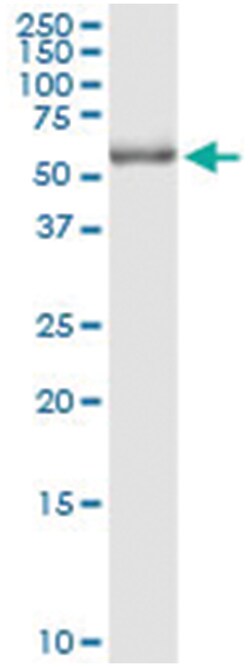 anti-POLG2, Human, IP-WB Antibody Pair, Abnova&trade;