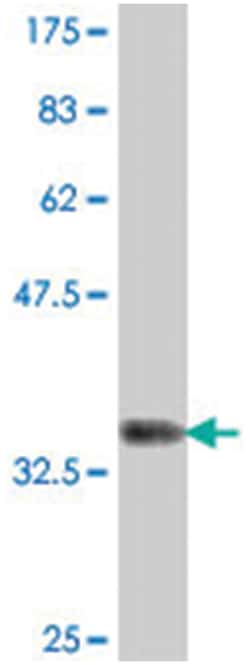RNF24, Mouse, Polyclonal Antibody, Abnova 50&mu;L; Unlabeled:Antibodies,