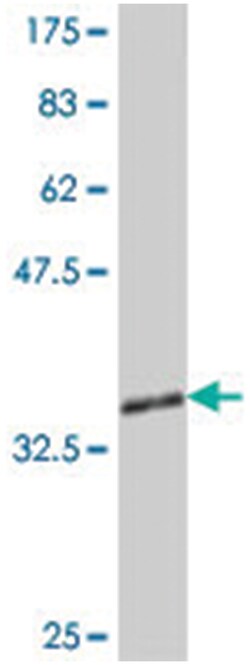 ZHX1, Mouse, Polyclonal Antibody, Abnova 50&mu;L; Unlabeled:Antibodies,