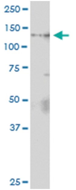 anti-ZHX1, Human, IP-WB Antibody Pair, Abnova 1 Set:Antibodies, Monoclonal/Polyclonal