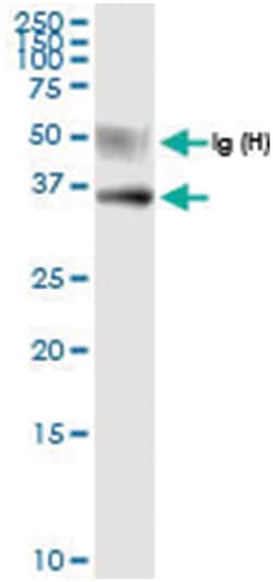 anti-USP18, Human, IP-WB Antibody Pair, Abnova&trade;