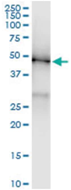 anti-KLF8, Human, IP-WB Antibody Pair, Abnova 1 Set | Buy Online | Abnova Corporation | Fisher Scientific