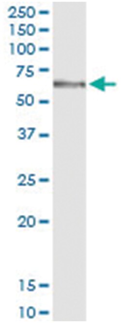anti-MGAT4B, Human, IP-WB Antibody Pair, Abnova 1 Set | Buy Online | Abnova | Fisher Scientific