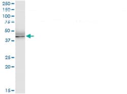 anti-GPN1, Human, IP-WB Antibody Pair, Abnova 1 Set:Antibodies, Monoclonal/Polyclonal