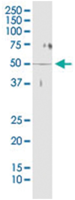 anti-STK38, Human, IP-WB Antibody Pair, Abnova 1 Set:Antibodies, Monoclonal/Polyclonal