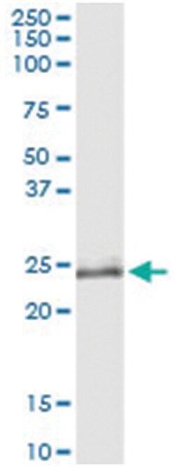 OIP5, Human, IP-WB Antibody Pair (PW1), Abnova™