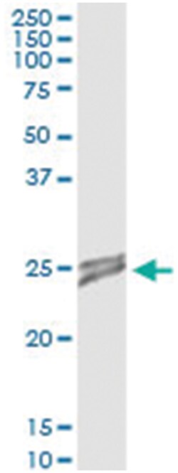 OIP5, Human, IP-WB Antibody Pair (PW2), Abnova&trade;