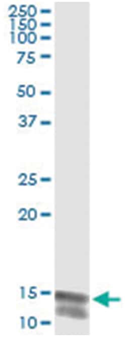 Abnova anti-NLGN4Y, Human, IP-WB Antibody Pair, Abnova™