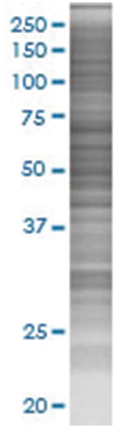 NTNG1 293T Cell Overexpression Lysate (Denatured), Abnova 100 &mu;L | Buy Online | Abnova | Fisher Scientific