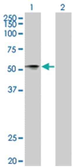 NTNG1 293T Cell Overexpression Lysate (Denatured), Abnova 100 &mu;L | Buy Online | Abnova | Fisher Scientific