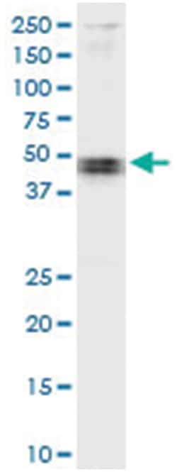 anti-CARD8, Human, IP-WB Antibody Pair, Abnova&trade;