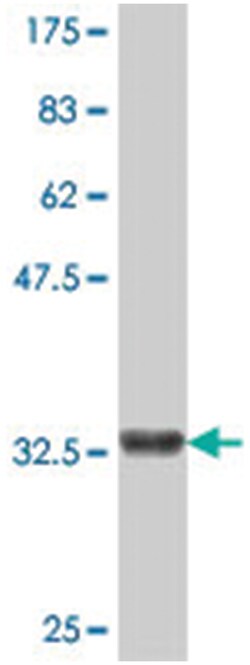SHANK2, Mouse, Polyclonal Antibody, Abnova 50&mu;L; Unlabeled:Antibodies,