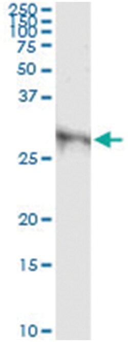 DKK1, Human, IP-WB Antibody Pair (PW2), Abnova&trade;