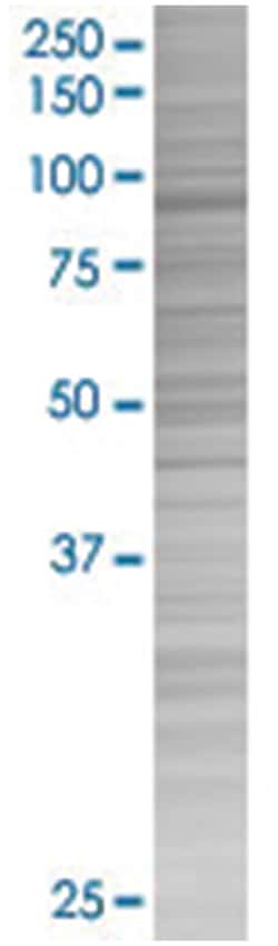PAXIP1 293T Cell Overexpression Lysate (Denatured), Abnova 100 &mu;L | Buy Online | Abnova | Fisher Scientific