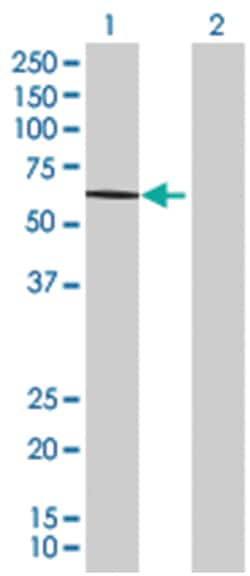 PAXIP1 293T Cell Overexpression Lysate (Denatured), Abnova 100 &mu;L | Buy Online | Abnova | Fisher Scientific