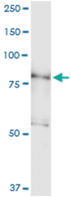 anti-PDXDC1, Human, IP-WB Antibody Pair, Abnova™