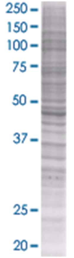 KIAA0261 293T Cell Overexpression Lysate (Denatured), Abnova 100 &mu;l | Buy Online | Abnova | Fisher Scientific