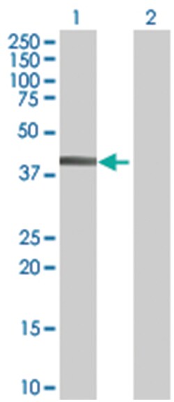KIAA0261 293T Cell Overexpression Lysate (Denatured), Abnova 100 &mu;l | Buy Online | Abnova | Fisher Scientific
