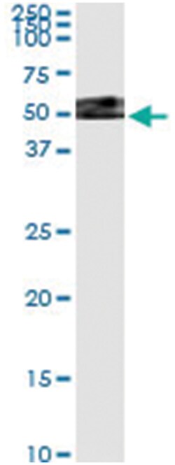 anti-TXNDC4, Human, IP-WB Antibody Pair, Abnova™