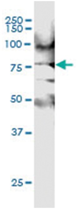 anti-MAP3K7IP2, Human, IP-WB Antibody Pair, Abnova 1 Set:Antibodies, Monoclonal/Polyclonal
