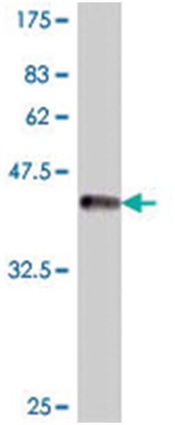 SMC5L1, Mouse, Polyclonal Antibody, Abnova 50&mu;L; Unlabeled:Antibodies,