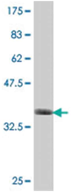 GANAB, Mouse, Polyclonal Antibody, Abnova 50&mu;L; Unlabeled:Antibodies,
