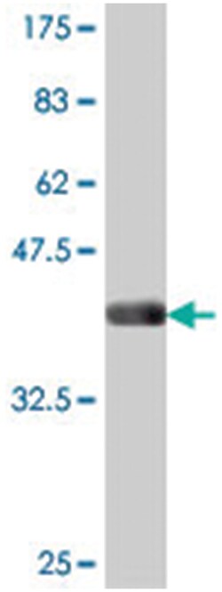 JMJD6 (PTDSR), Mouse, Polyclonal Antibody, Abnova 50 &mu;L | Buy Online | Abnova Corporation | Fisher Scientific