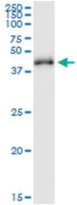 anti-RRS1, Human, IP-WB Antibody Pair, Abnova&trade;