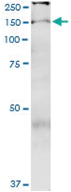 anti-TBC1D1, Human, IP-WB Antibody Pair, Abnova™