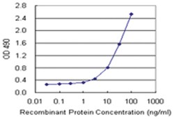 anti-MGRN1, Human, Matched Antibody Pair, Abnova™