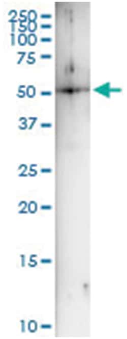 anti-UBR2, Human, IP-WB Antibody Pair, Abnova&trade;