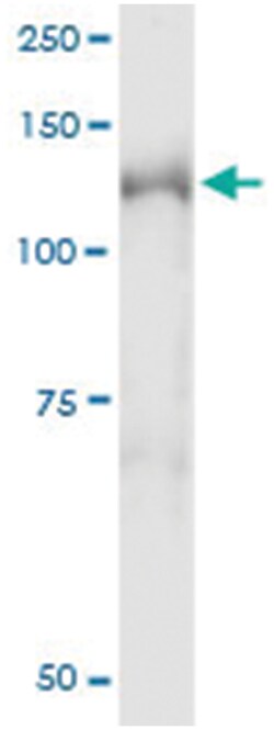 anti-NEDD4L, Human, IP-WB Antibody Pair, Abnova 1 Set:Antibodies, Monoclonal/Polyclonal