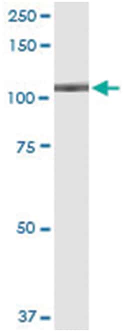 anti-VPS39, Human, IP-WB Antibody Pair, Abnova&trade;
