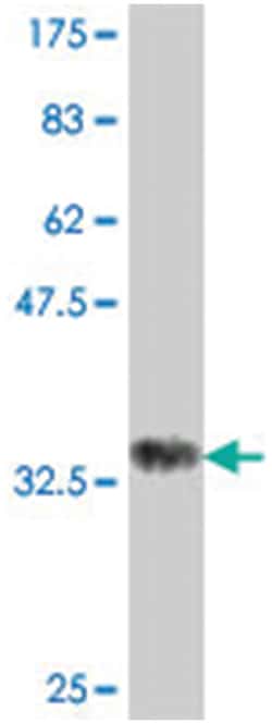 UBR4 (RBAF600), Mouse, Polyclonal Antibody, Abnova 50&mu;L; Unlabeled:Antibodies,