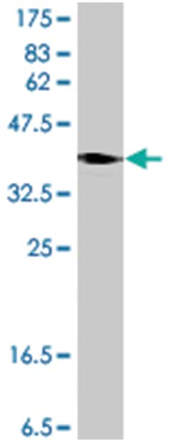 ARHGEF12, Mouse, Polyclonal Antibody, Abnova™