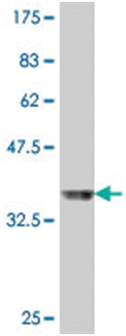 MED13L (THRAP2), Mouse, Polyclonal Antibody, Abnova 50 &mu;L | Buy Online | Abnova Corporation | Fisher Scientific