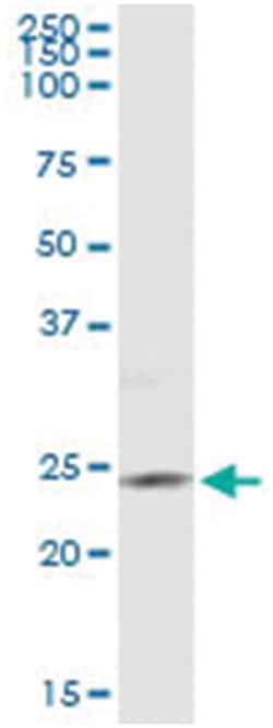 anti-PIP5K1C, Human, IP-WB Antibody Pair, Abnova&trade;