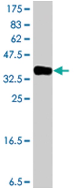ATP13A2, Mouse, Polyclonal Antibody, Abnova 50&mu;L; Unlabeled:Antibodies,