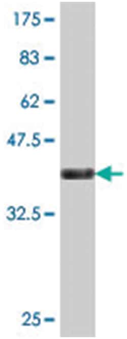 sirtuin (silent mating type information regulation 2 homolog) 1 (S. cerevisiae),