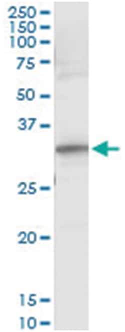 RYBP, Human, IP-WB Antibody Pair (PW3), Abnova&trade;