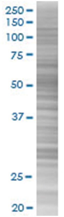 CBX6 293T Cell Overexpression Lysate (Denatured), Abnova 100 &mu;L | Buy Online | Abnova | Fisher Scientific