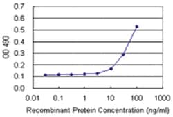 anti-CBX5 Matched Antibody Pair, Abnova&trade;