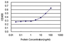 QPRT, Human, Matched Antibody Pair (AP11), Abnova™